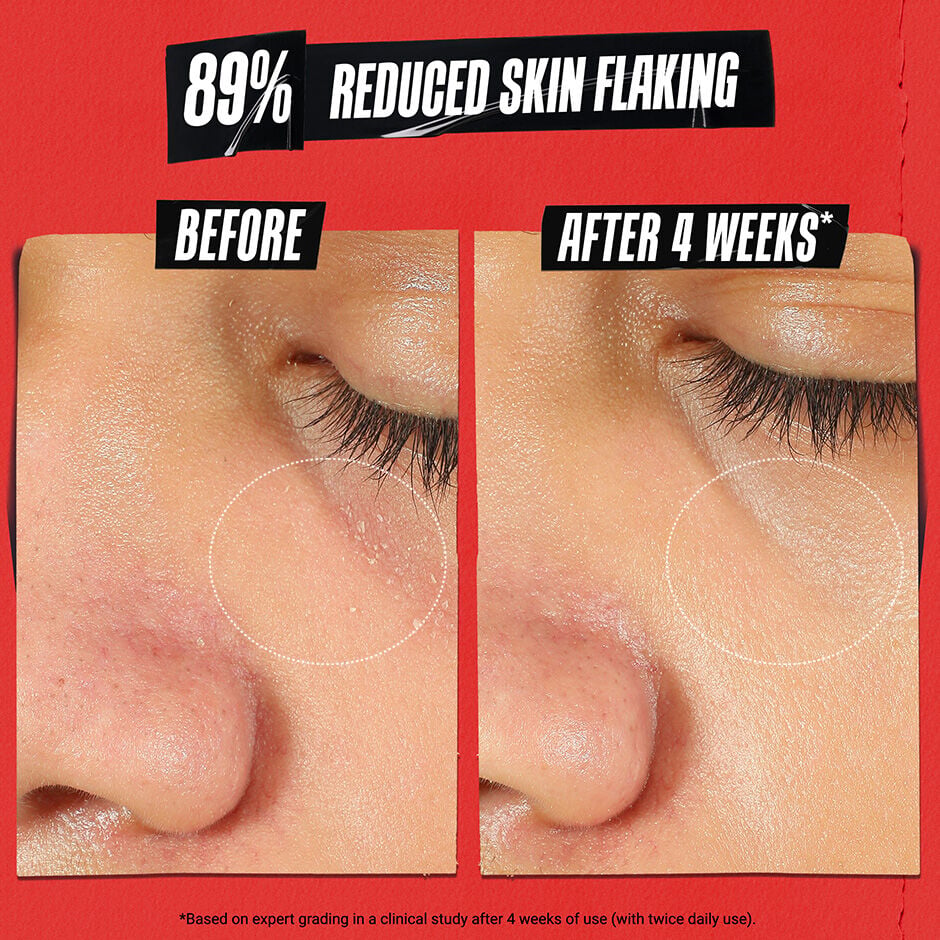 Ultra Facial Medicated Meltdown Recovery Cream – Kiehl's